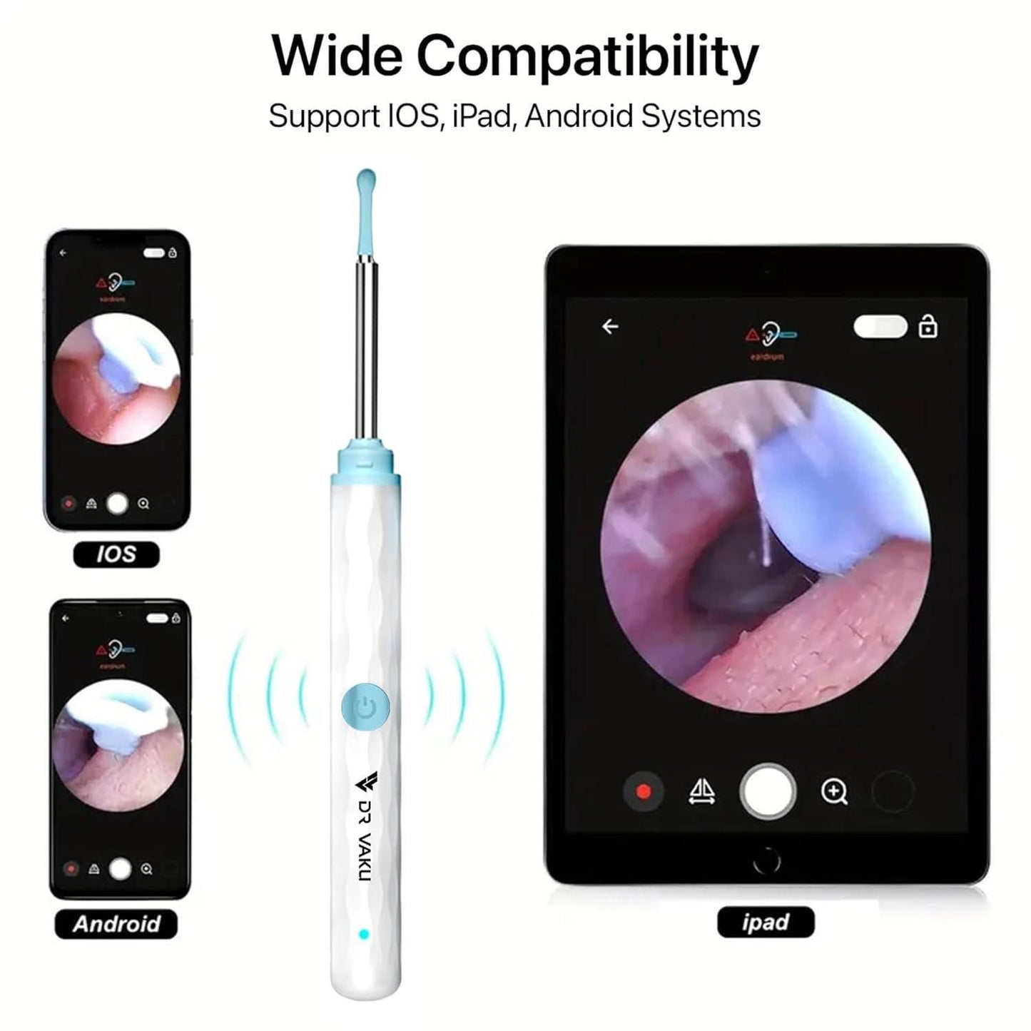 Smart Visual Ear Wax Cleaner 2025