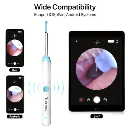 Smart Visual Ear Wax Cleaner 2025