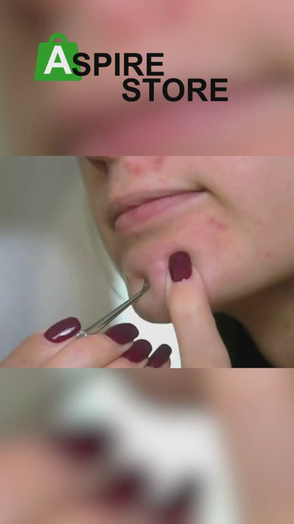 Stainless Steel Blackhead Remover Extractor Tool Set of 4